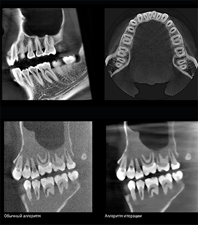 RAYSCAN Alpha+ 160 (1)-21.jpg