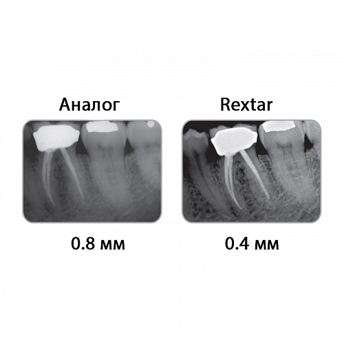 POSDION Rextar - портативный рентген